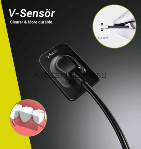 V-Sensör İntraoral X-Ray Sensörü RVG - Sensör Size 1