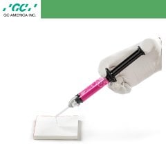 G-Cem Veneer Refil