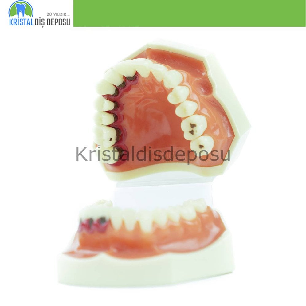 Periodontist Eğitim Modeli