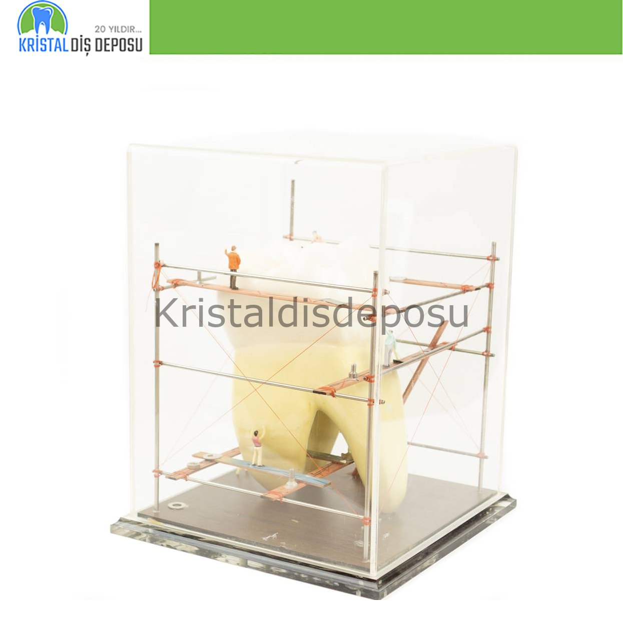 Cam Fanus Büyük Diş Model